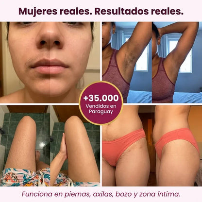 Aceite Caramela Beauty de Cyperus Rotundus para la reducción natural del vello