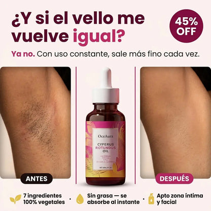Aceite Caramela Beauty de Cyperus Rotundus para la reducción natural del vello