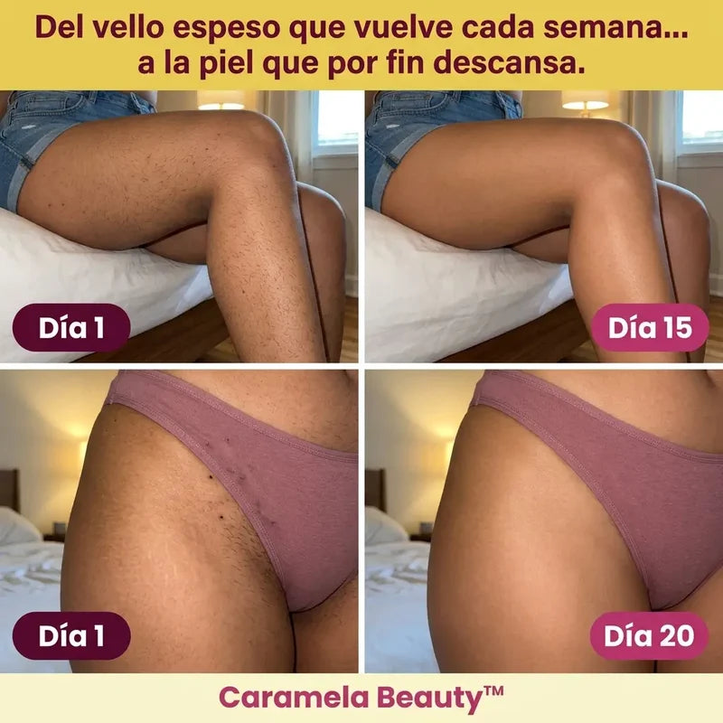 Aceite Caramela Beauty de Cyperus Rotundus para la reducción natural del vello